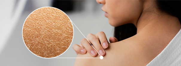 Hati-hati, Ini 8 Kebiasaan yang Membuat Kamu Kulit Kusam!